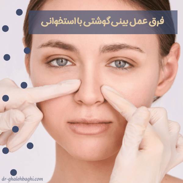 فرق عمل بینی گوشتی با استخوانی 