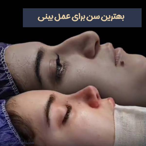 بهترین سن عمل بینی