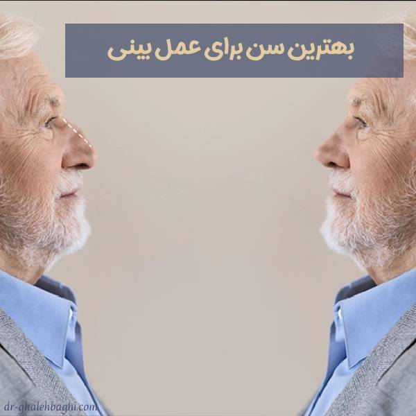 عمل بینی در سن بالا