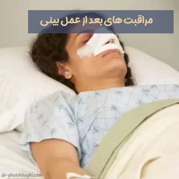 مراقبت های بعد از عمل بینی