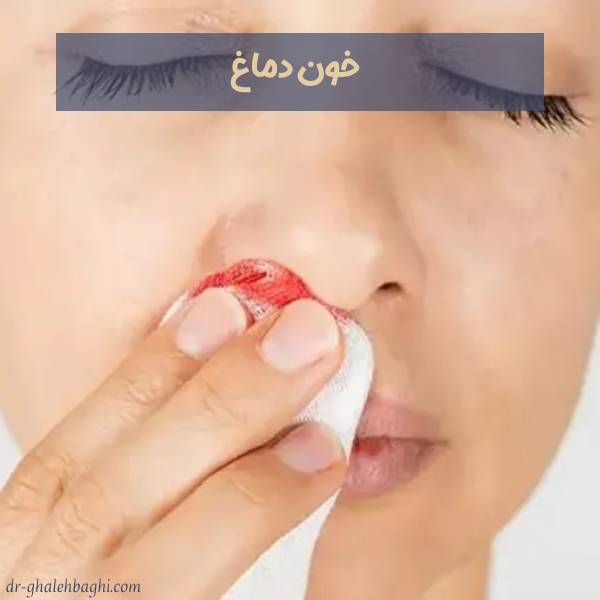 عکس خون دماغ ناگهانی