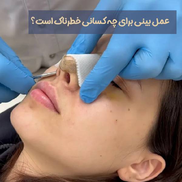 عمل بینی برای چه کسانی خطرناک است؟