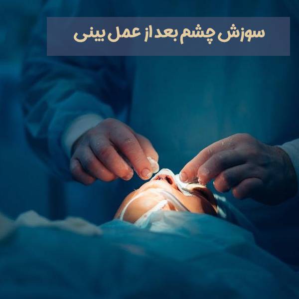 سوزش چشم بعد از عمل بینی