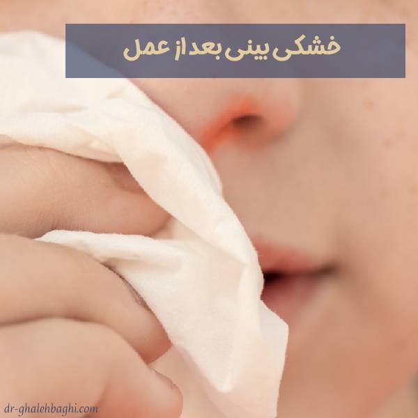 خشکی بینی بعد از عمل