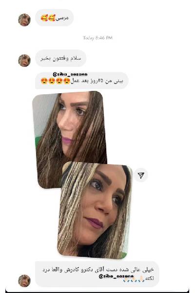 نظرات بیماران بهترین جراح بینی در تهران