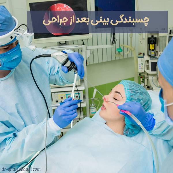چسبندگی بینی بعد از عمل 