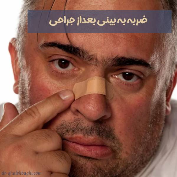 ضربه خوردن به بینی بعد از جراحی
