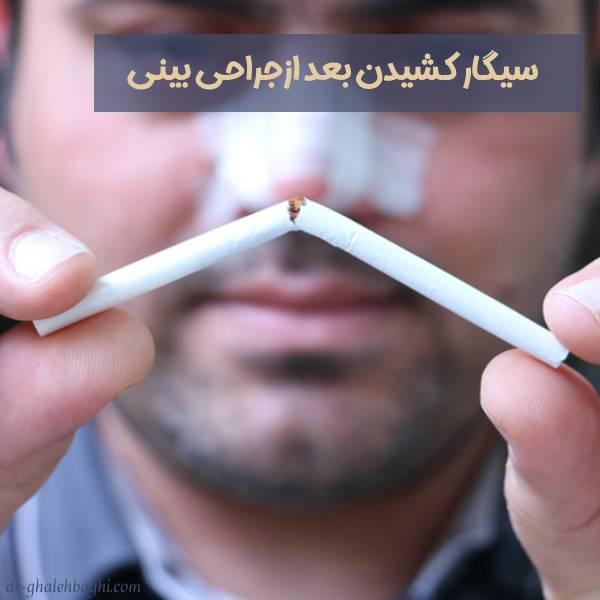 سیگار کشیدن بعد از جراحی بینی