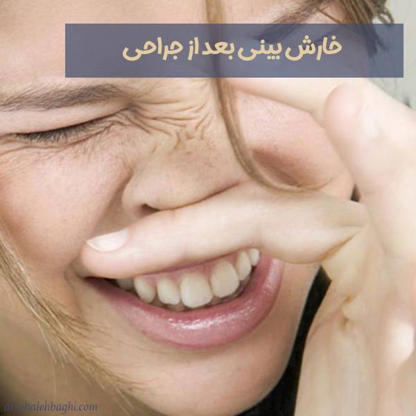 خارش بینی بعد از عمل