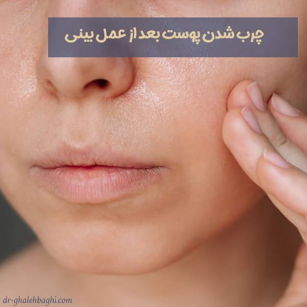چربی پوست بعد از عمل بینی