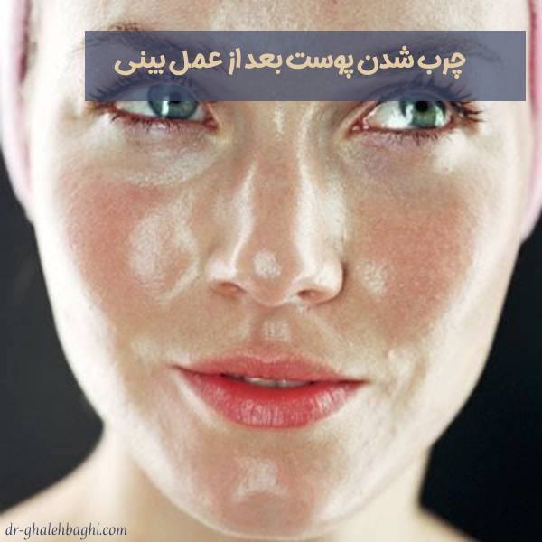 چربی پوست بعد از عمل بینی