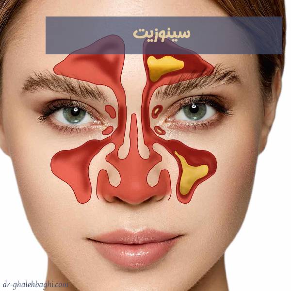 عکس سینوزیت بینی