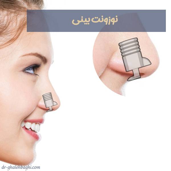 نوزونت