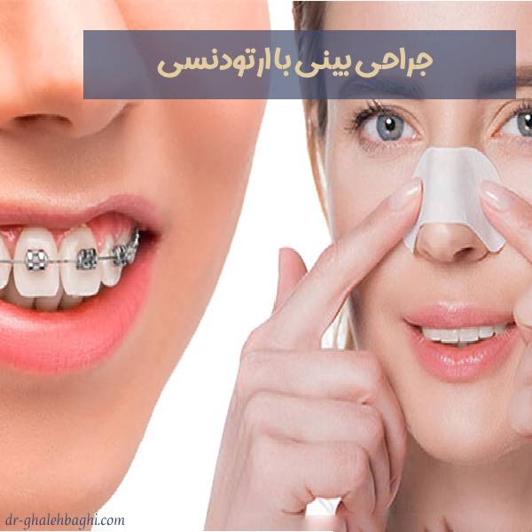 جراحی بینی با ارتودنسی