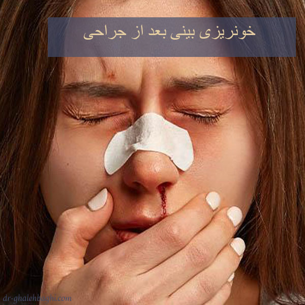خونریزی بینی بعد از عمل