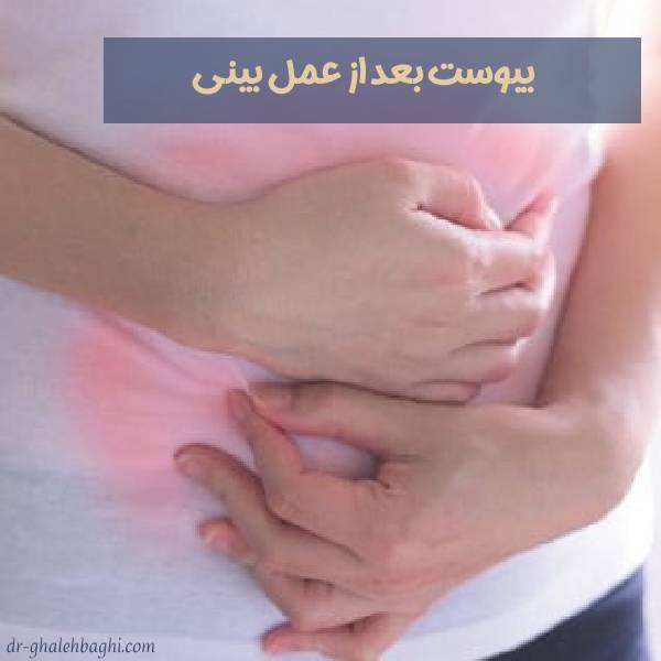 یبوست بعد از جراحی بینی