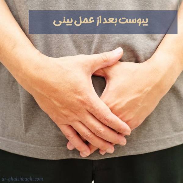 یبوست بعد از عمل بینی